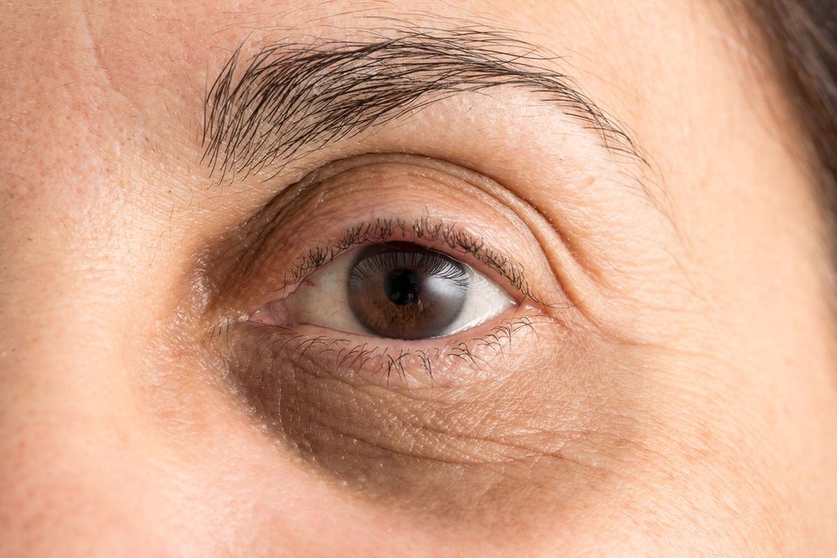 Treatment Mata Panda Peeling di Reglow Clinic, Rahasia Area Bawah Mata Lebih Cerah dan Sehat