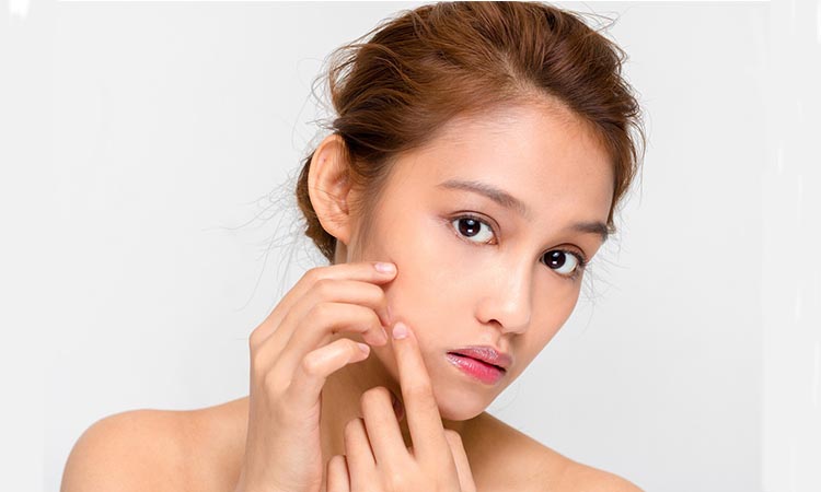 Progresnya Terlihat Banget! Treatment Jerawat Ini Bikin Kulit Lebih Mulus dan Cerah