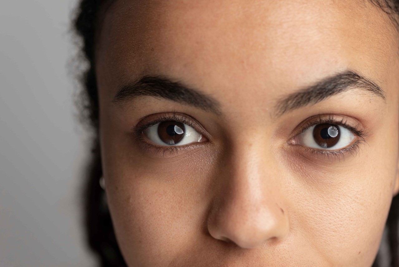 Dark Circle Tak Hilang Meski Sudah Cukup Tidur? Ini Alasannya